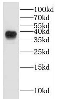 GALM Antibody