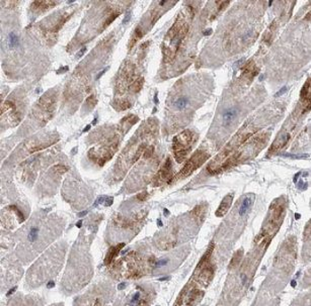 GALM Antibody