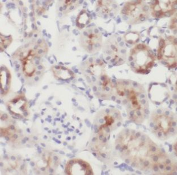 GALNT14 Antibody