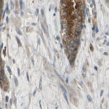 GALNT4 Antibody