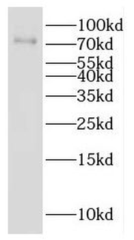 GALNT7 Antibody