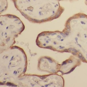 GALNT15 Antibody