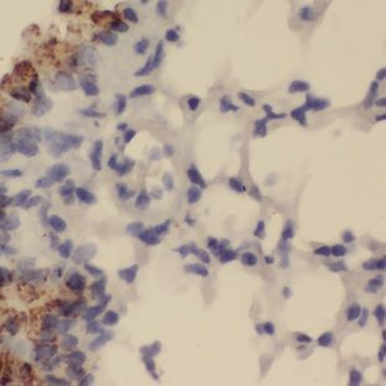GALNTL5 Antibody