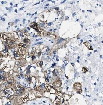 AP1G1 Antibody