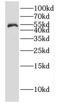 gamma Tubulin Rabbit Polyclonal Antibody