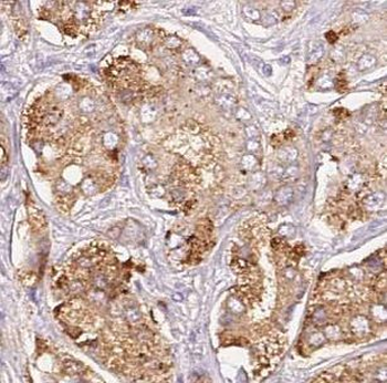 GAMT Antibody