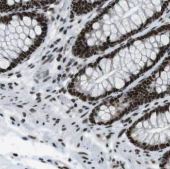 GAR1 Antibody