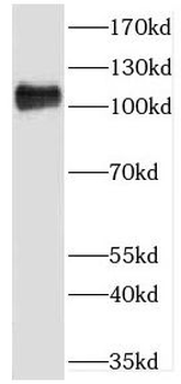 GART Antibody