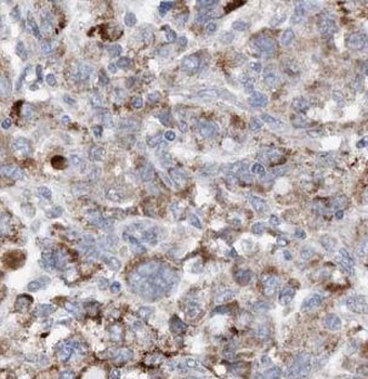 GART Antibody