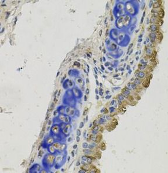 GAS6 Antibody