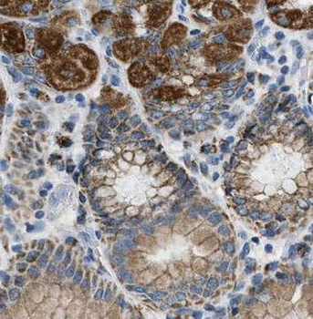 GAST Rabbit Polyclonal Antibody