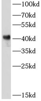 GATA1 Mouse Monoclonal Antibody