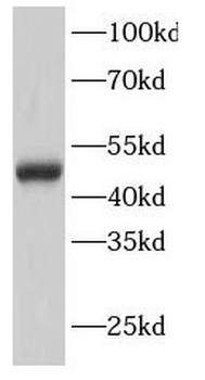 GATA3 Rabbit Polyclonal Antibody