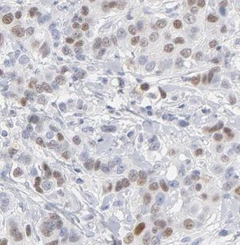 GATA3 Rabbit Polyclonal Antibody