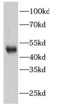 GATA3 Rabbit Polyclonal Antibody