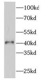 GATA5 Antibody