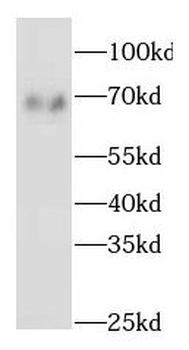 GATAD2B Rabbit Polyclonal Antibody