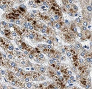 GATC Antibody