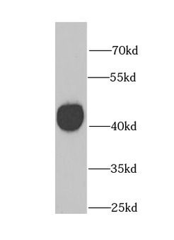 GATM Antibody