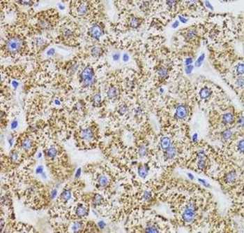 GATM Antibody