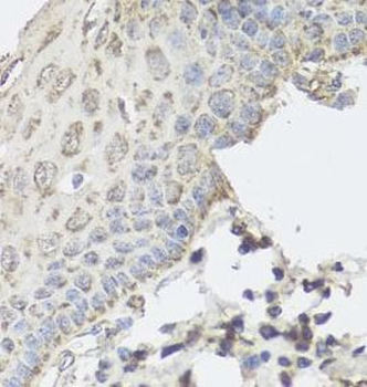 GBF1 Rabbit Polyclonal Antibody