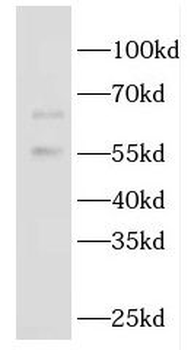 GBP5 Antibody