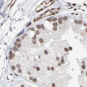 GBP5 Antibody