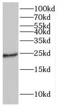 GUCA1A Antibody