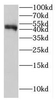 GCAT Antibody