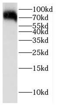 GCLC Antibody