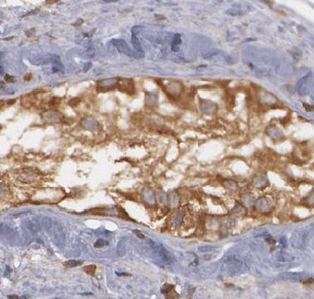 NR6A1 Antibody