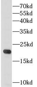 CSF3 Rabbit Polyclonal Antibody