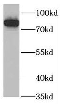 CSF3R Rabbit Polyclonal Antibody