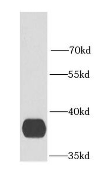 GDAP1 Antibody
