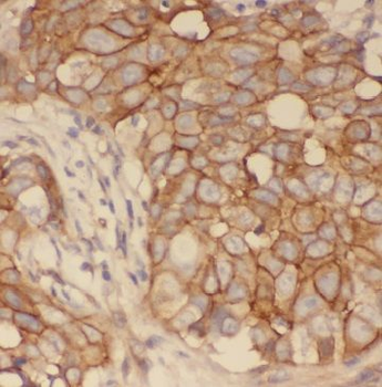 GDI1 Antibody