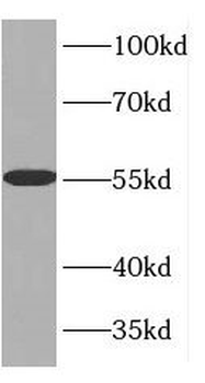 GDI1 Antibody