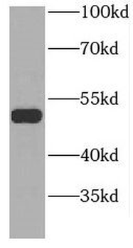GDI2 Antibody