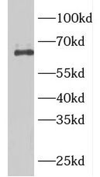ARHGEF25 Antibody