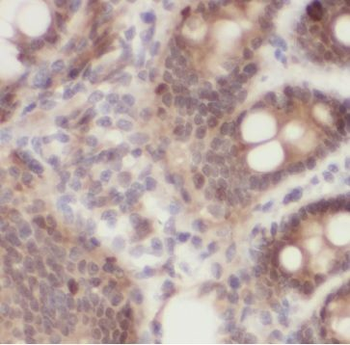 GSN Antibody