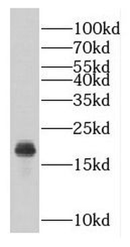 GEMIN6 Antibody