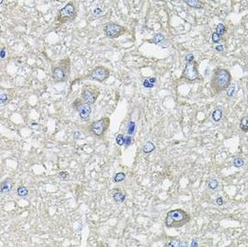 GFPT1 Antibody