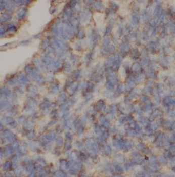 GGCT Antibody