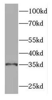 GGPS1 Antibody