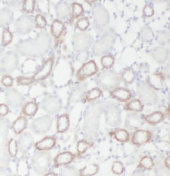 GGPS1 Antibody