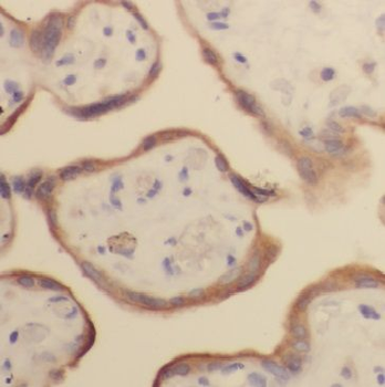 GH2 Antibody