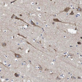 GHDC Antibody