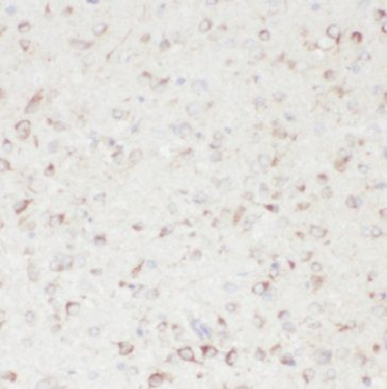GHITM Antibody