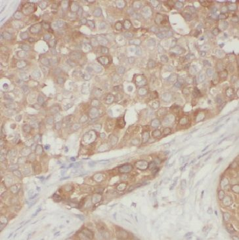 GIGYF2 Antibody