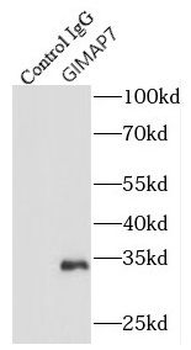 GIMAP7 Rabbit Polyclonal Antibody