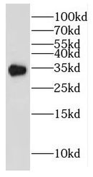 GIPC2 Rabbit Polyclonal Antibody
